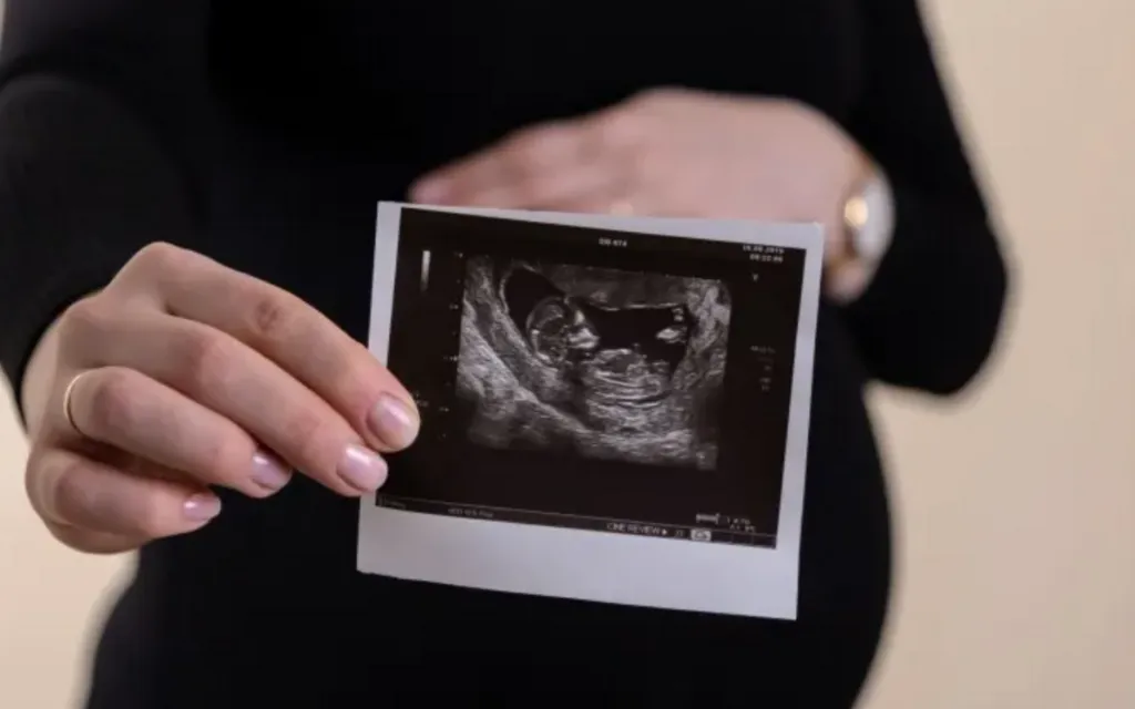 Denuncian intento de permitir el aborto hasta los 9 meses en todo México