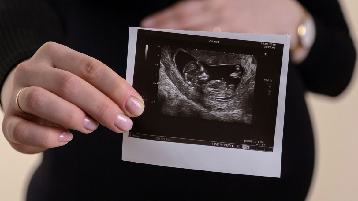 Noruega: Obispos rechazan proyecto de ley que permitiría el aborto hasta casi los 5 meses de embarazo