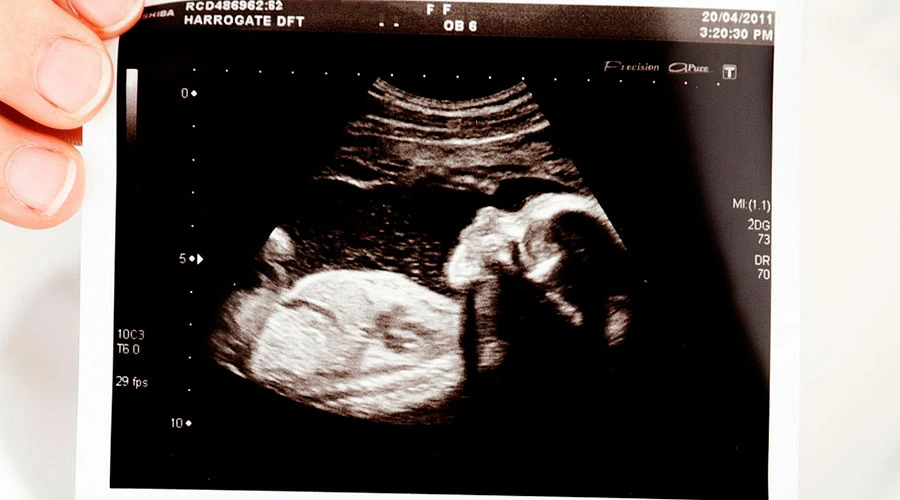 Presentan resultados “prometedores” sobre la naprotecnología, técnica acorde al magisterio católico 